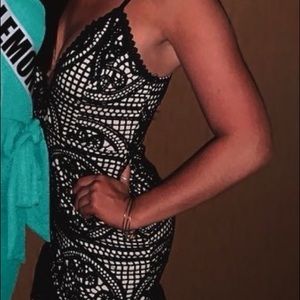 Black and white lace dress